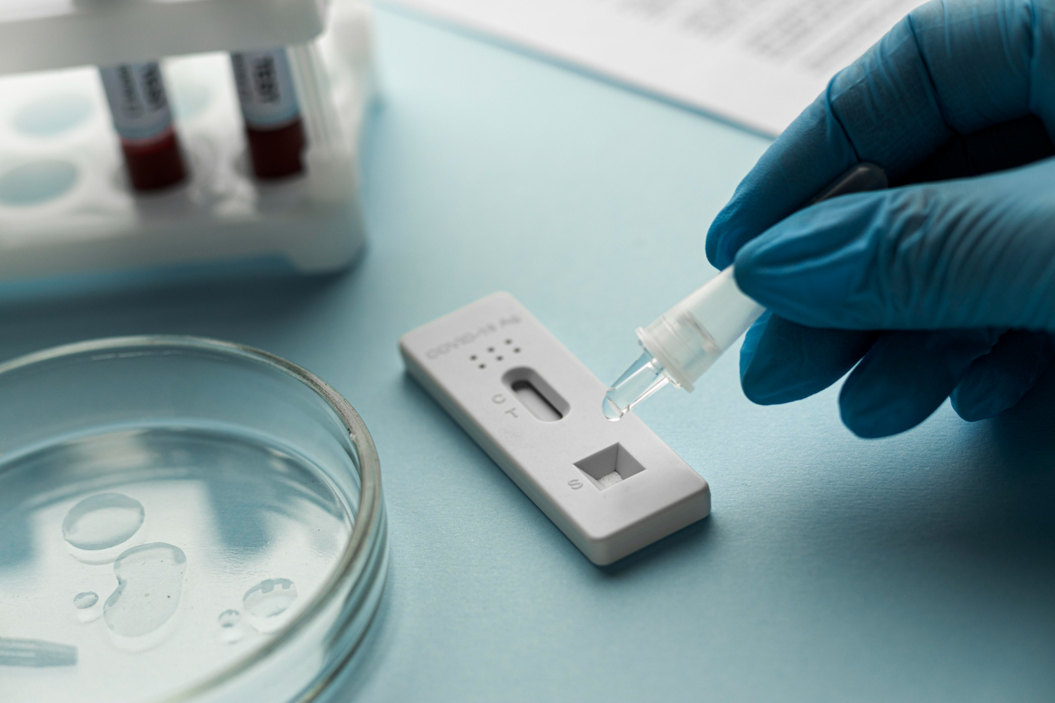Plasmid DNA Extraction Kit for Mosquito sample